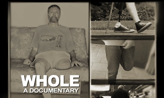 Whole: A New Documentary on a Troubling Disorder