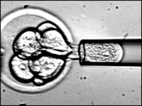 California’s Stem Cell Failure