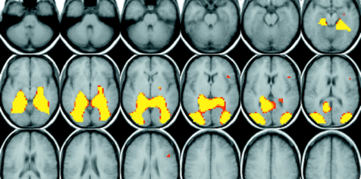 How Pornography Works: It Hijacks the Male Brain