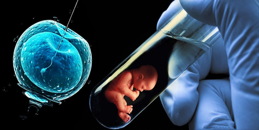 In Vitro Fertilization – Issues You Might Not Have Considered