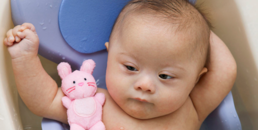 Japanese Scientists Can Erase Down Syndrome?