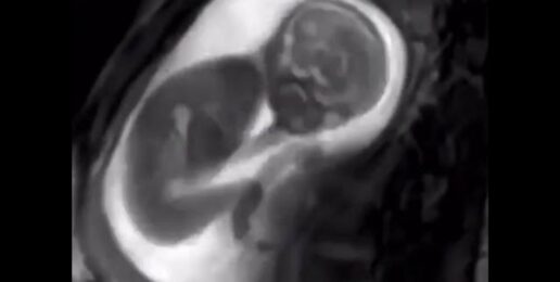 As you can see, this baby is not just a “clump of cells.” #shorts