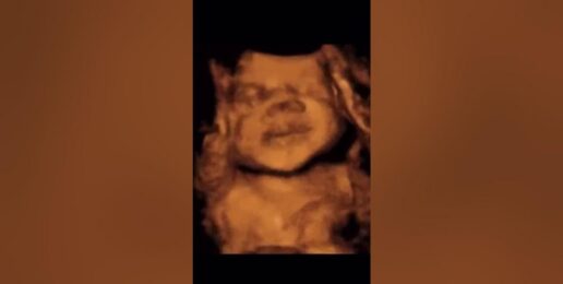 Not a clump of cells- but a unique human being who bears the image of God. 👣 #shorts